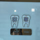 Tooth Shape - Smart NFC 2QR Table Top Standee - For Dental Clinic